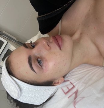 Адель Вейгель