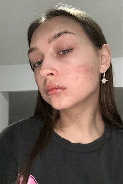 Nostya (Nostyanka)
